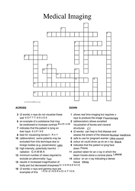We have found 1 possible solution matching: MRI output crossword clue. This clue was last seen on LA Times Crossword July 20 2023 Answers In case the clue …